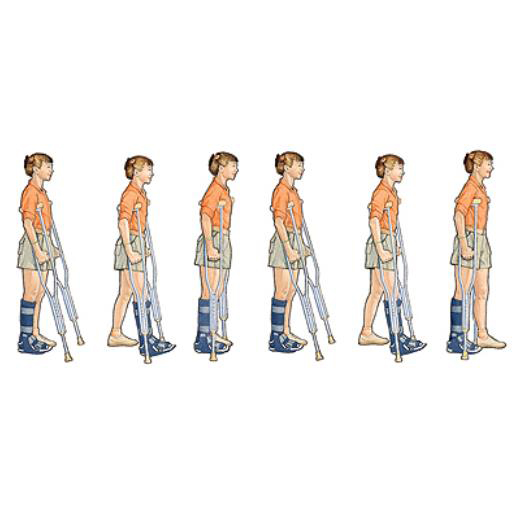 ProBasics Underarm Crutches Aluminum | Michigan USA ProBasics Underarm Crutches Aluminum 1 . (Tall, 5’10” – 6’6″) 2 . (Adult, 5’2″ – 5’10”) 3 . (Junior, 4’6″ – 5’2″)